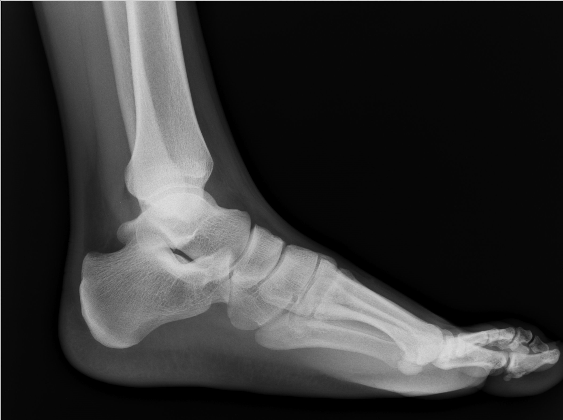 cat foot x ray